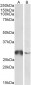 GSTO1 Antibody (internal region near C-Term)